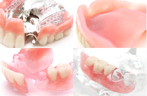 入れ歯の種類・技術料・保証のご案内