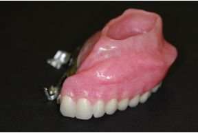 顎義歯