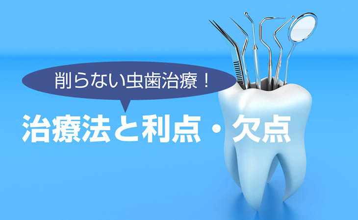 削らない虫歯治療！治療法と利点・欠点