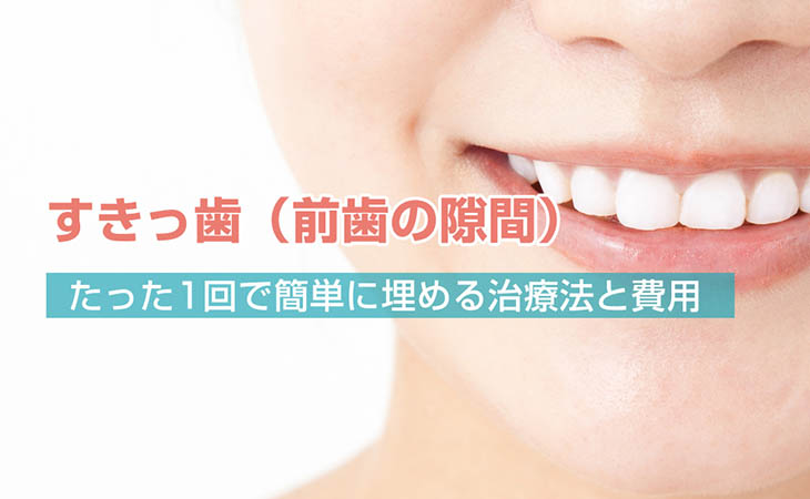 すきっ歯（前歯の隙間）を1回で簡単に埋める治療法と費用