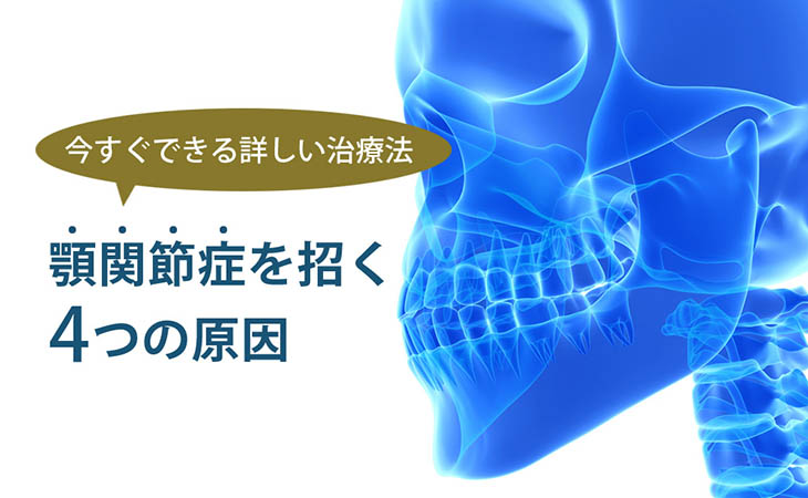 顎関節症は予防できますか?