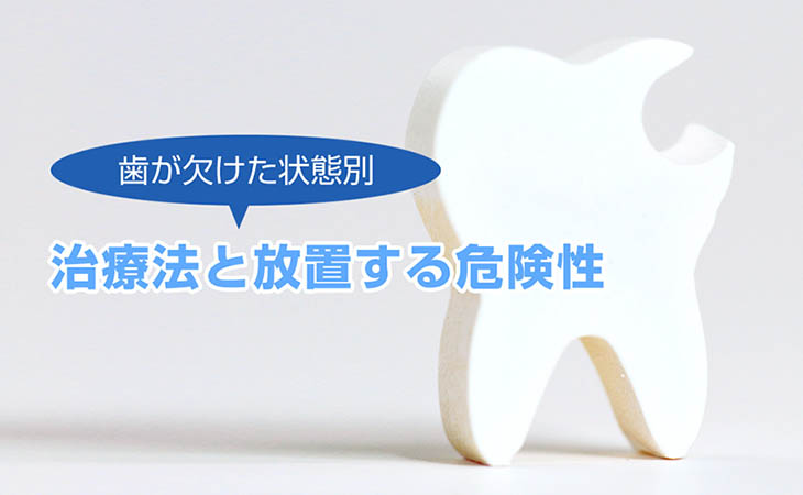 歯が欠けた状態別の治療法と放置する危険性