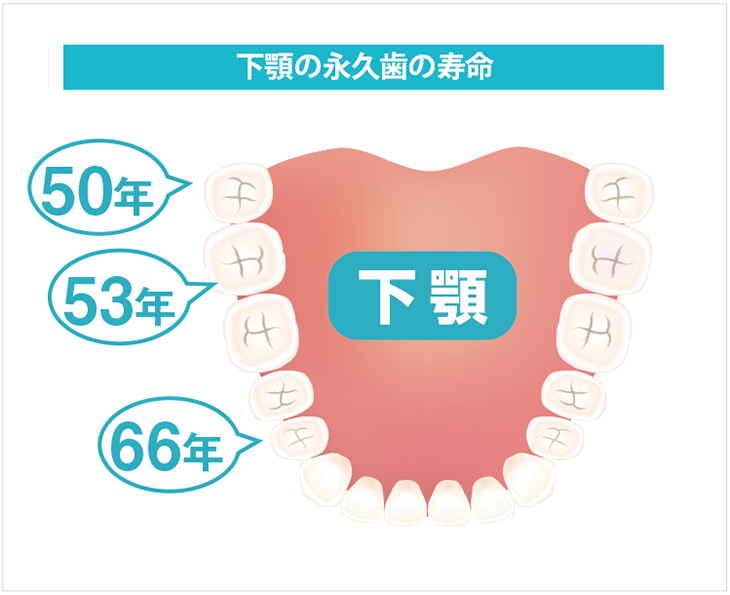 歯の寿命